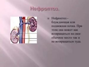 Опущение почки у ребенка