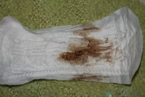 Скудные коричневые выделения один день